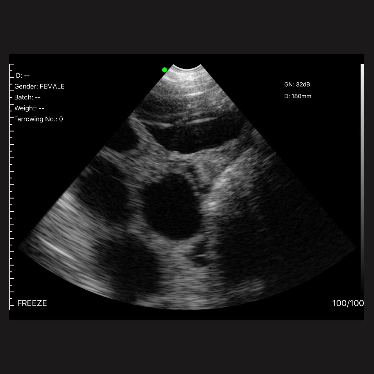 Ultrasound - Image 1 - Facebook