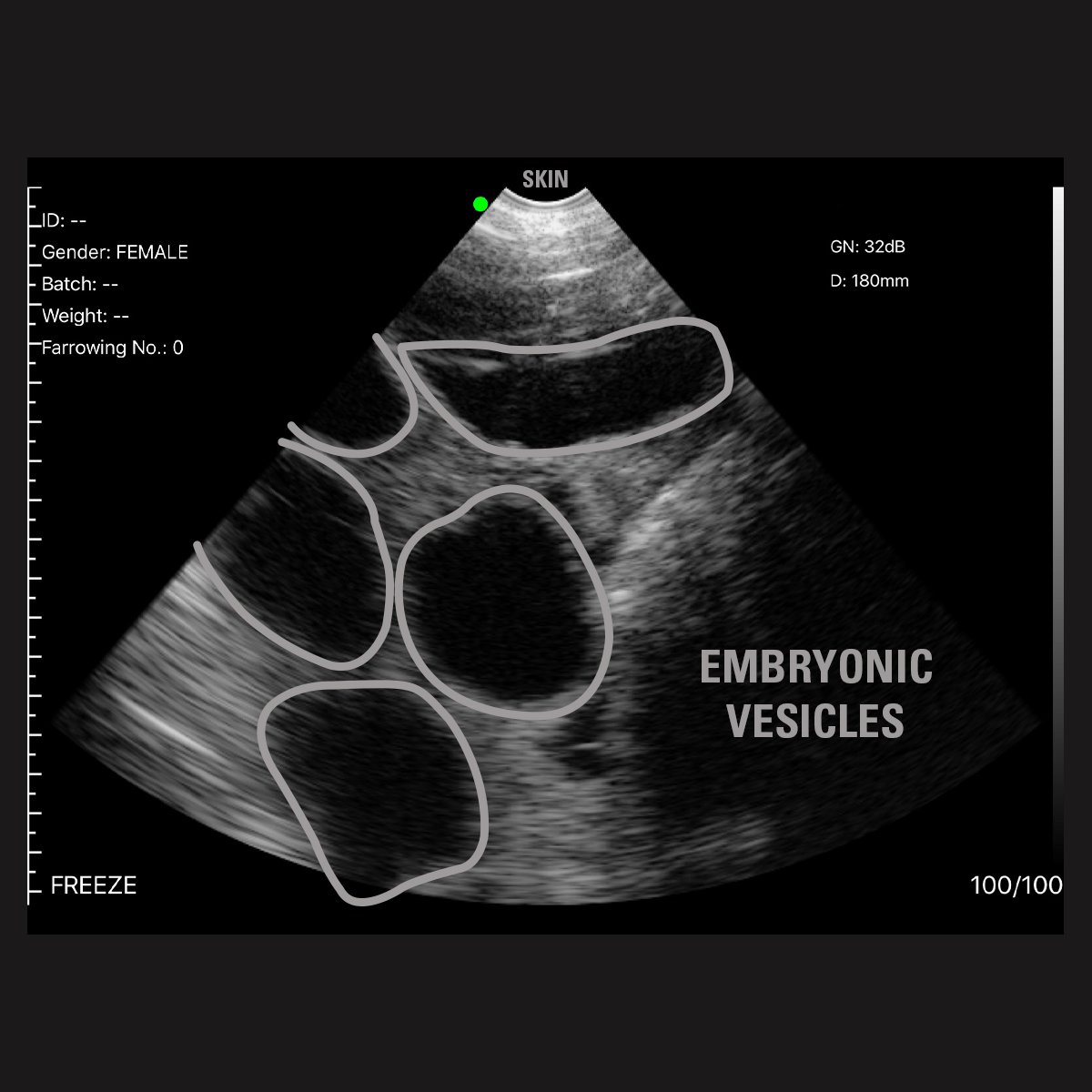 Ultrasound - Image 2 - Labeled - Facebook